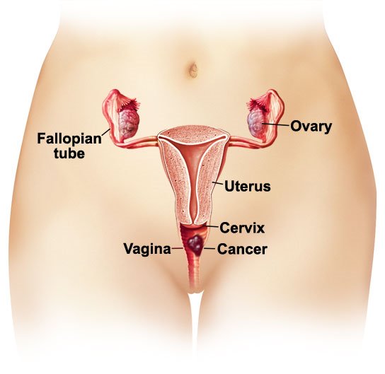 causes of bleeding after period